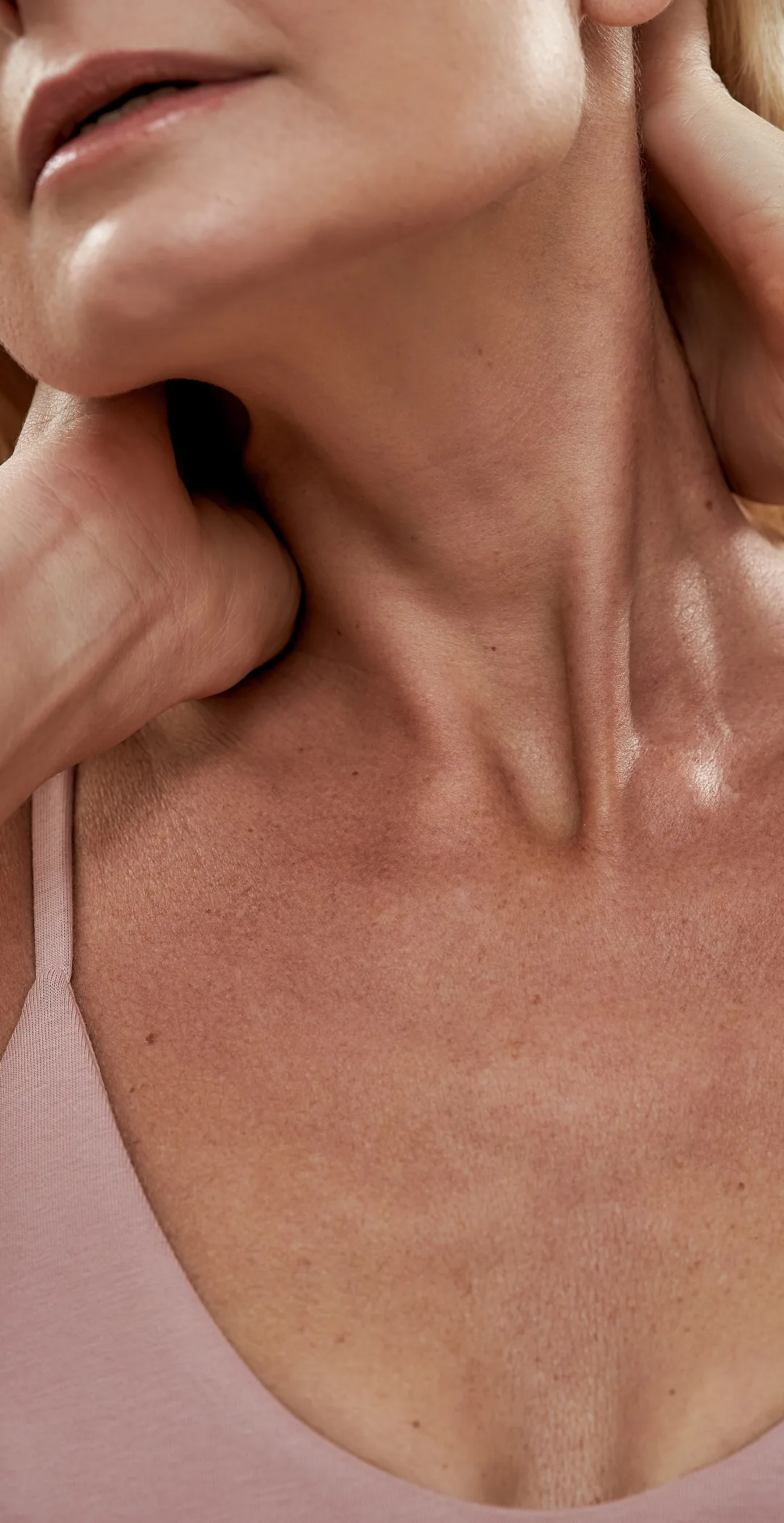 Rejuvenecimiento de Cuello y Escote