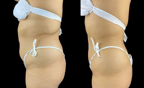 garasa localizada 1 gallery