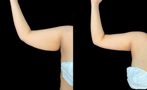 garasa localizada 3 gallery