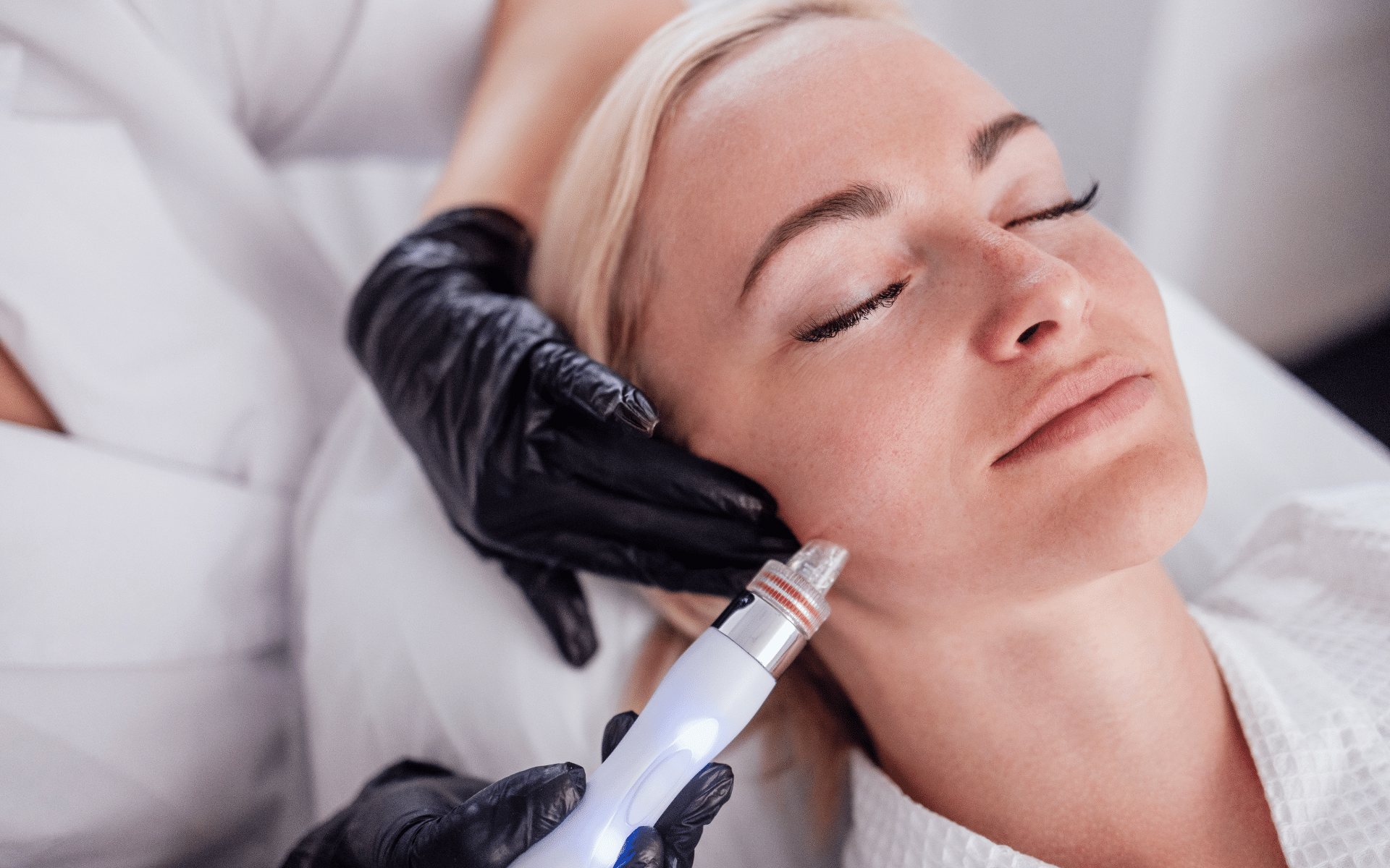 Conoce todo sobre los bioestimuladores de colágeno.