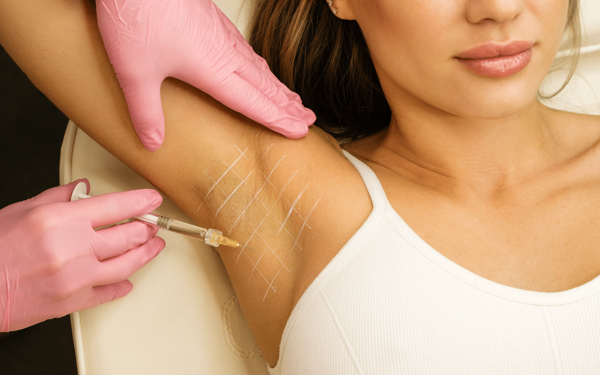 Conoce todo sobre la toxina botulínica.